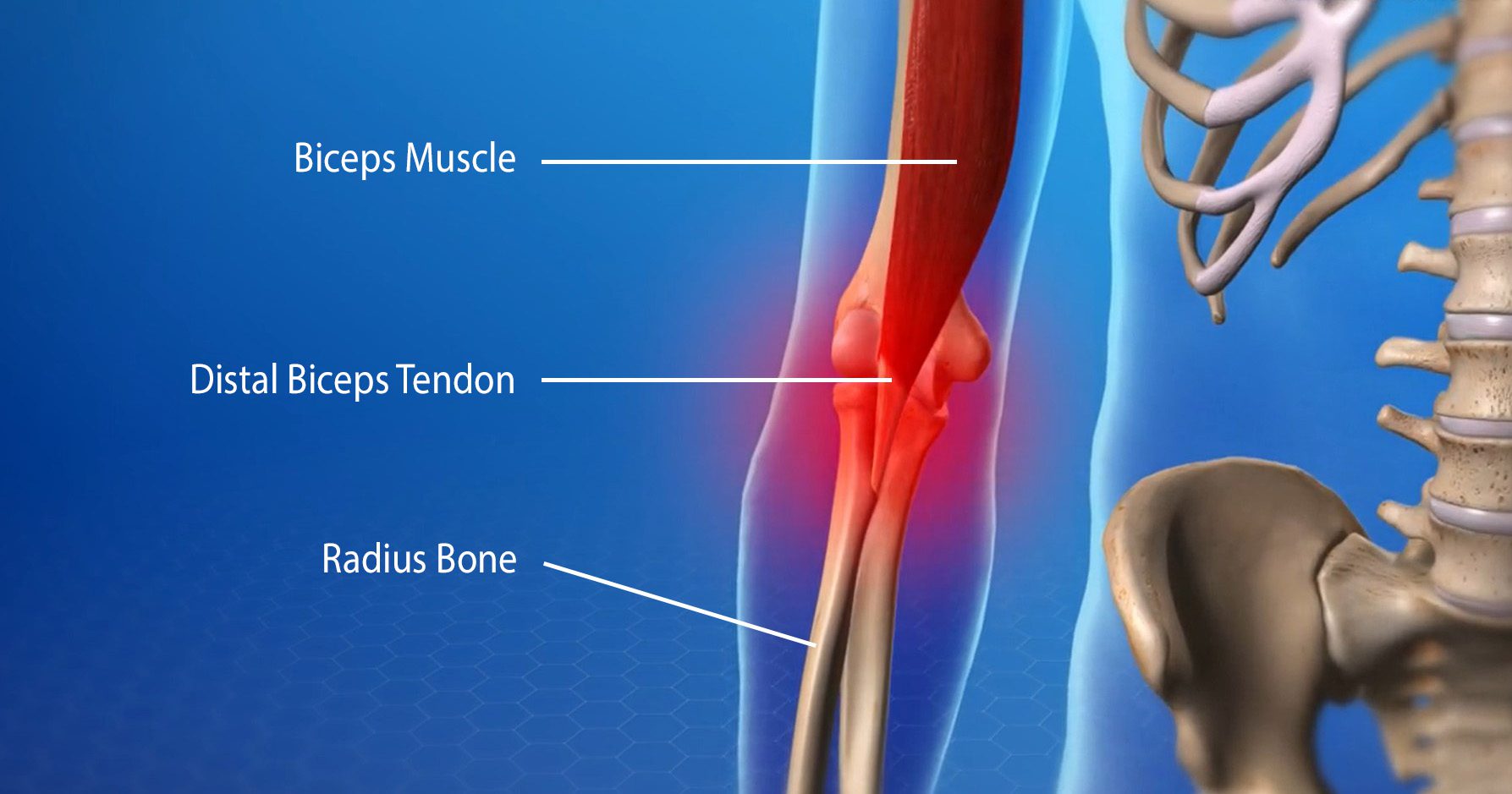 ACL Reconstruction surgery