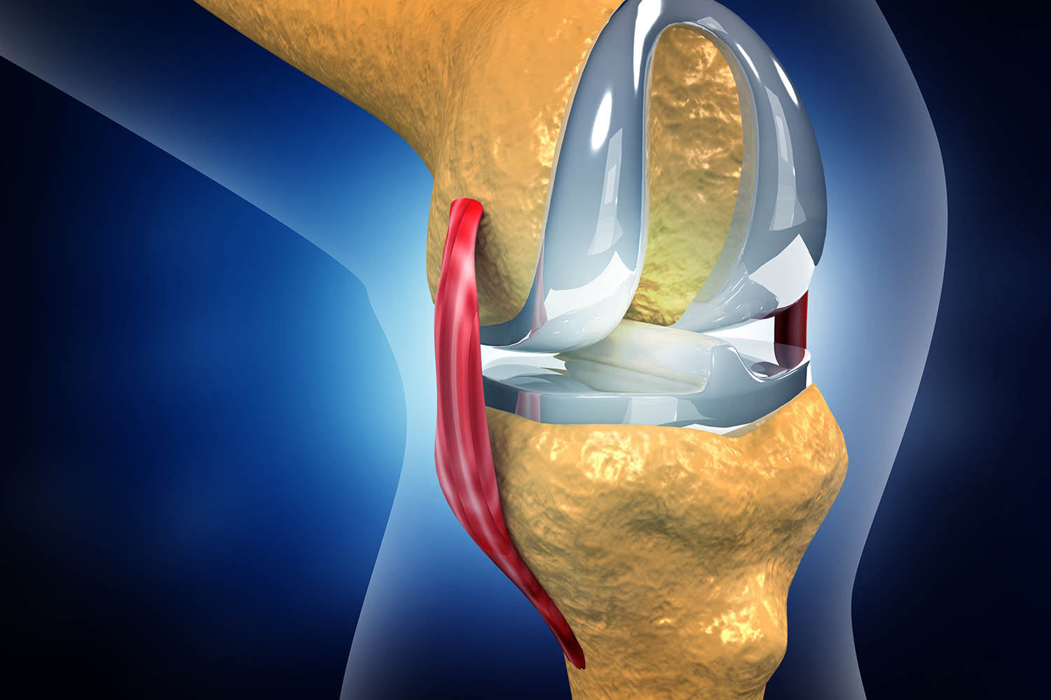 ACL Reconstruction surgery